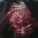 39 Week Ultrasound